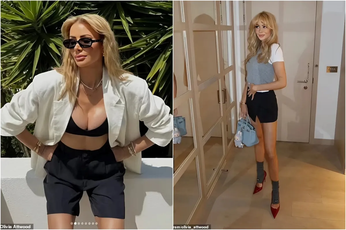 Olivia Attwood admits she 'was trying to look like a sex doll' while undergoing cosmetic surgery as she opens up on the benefits of having ADHD ngocc Olivia Attwood admits she 'was trying to look like a sex doll' while undergoing cosmetic surgery as she opens up on the benefits of having ADHD ngocc