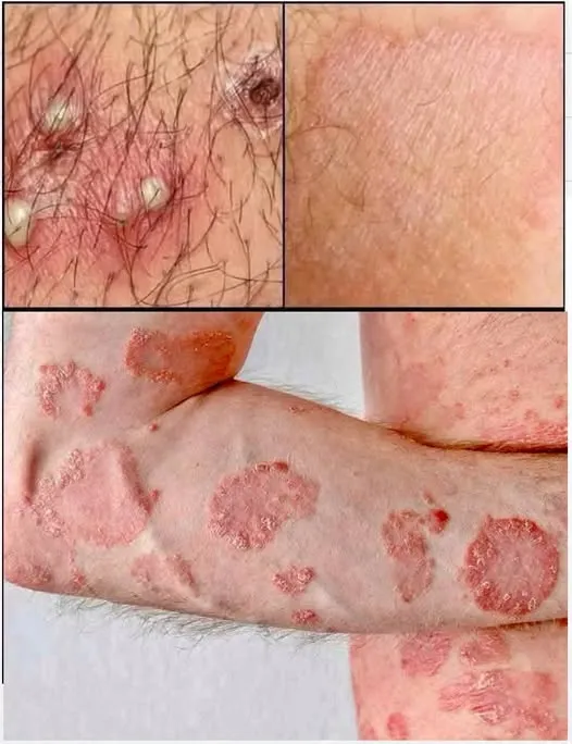 RF. These are the signs that he is cr… See more