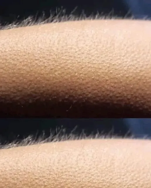Goosebumps: A Reflection of Emotions or a Survival Mechanism?