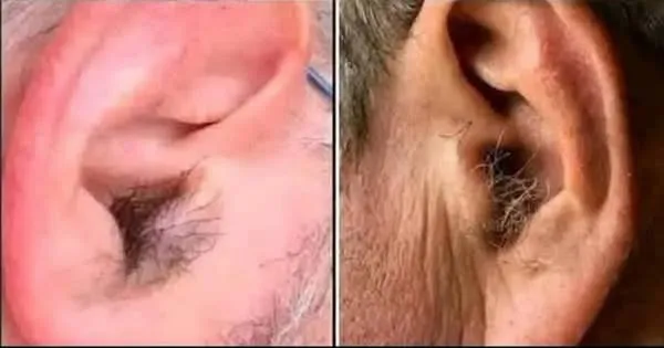 313 DID YOU KNOW that if hair grows on your ears, it’s because your body is…. Read more