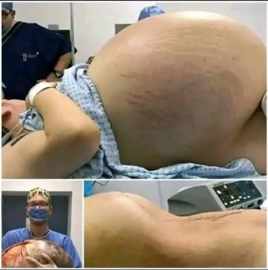 Understanding and Managing Those Painful Red Bumps