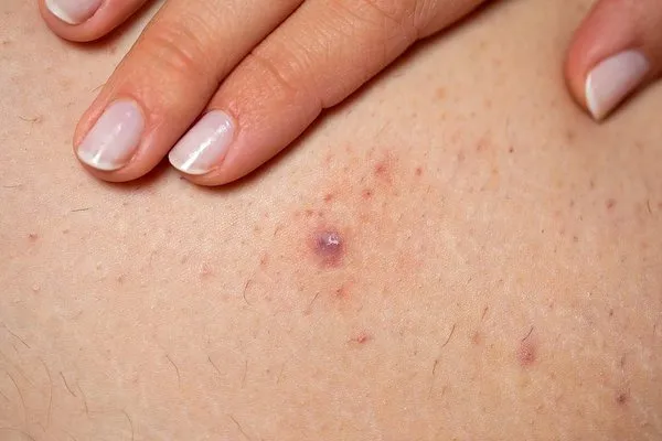 16. All the Symptoms of Stomach Cancer