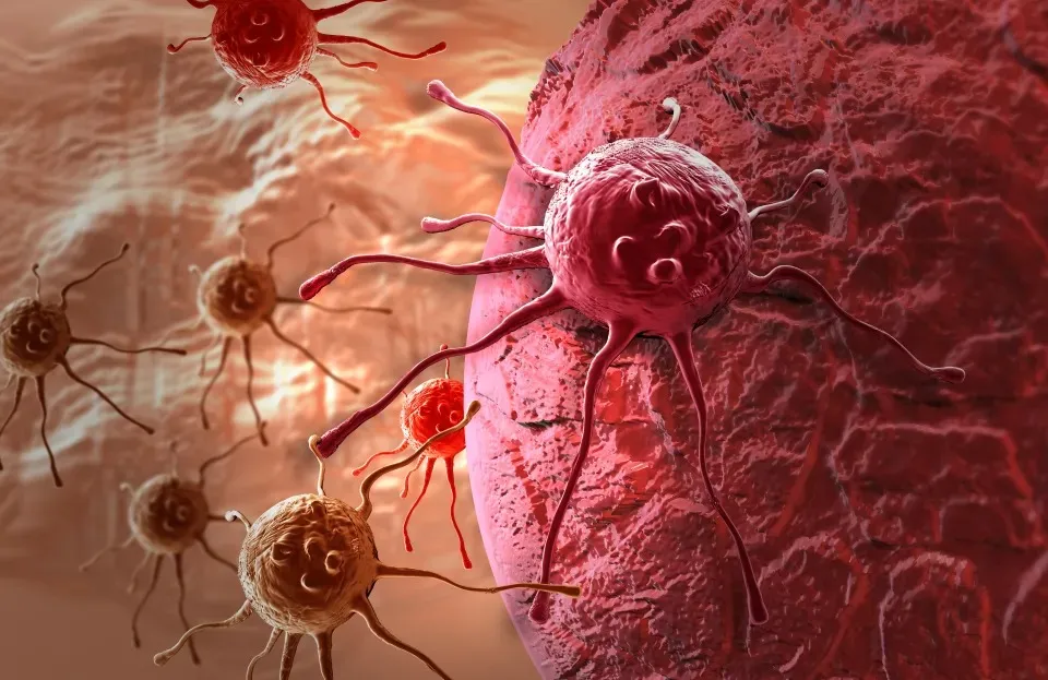 9. Early Warning Signs of Cancer You Should Never Ignore