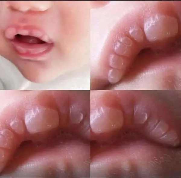 If your baby has these marks it means… See more