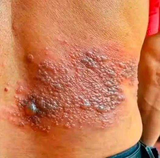 BE VERY CAREFUL . If you get this, you are infected with …. See more BE VERY CAREFUL . If you get this, you are infected with …. See more