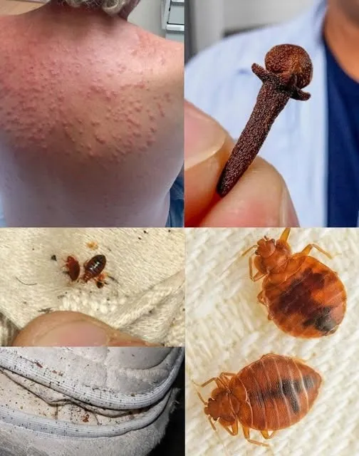 16. Natural Pest Control: Eliminate Bed Bugs and Household Pests with Diatomaceous Earth & Cloves