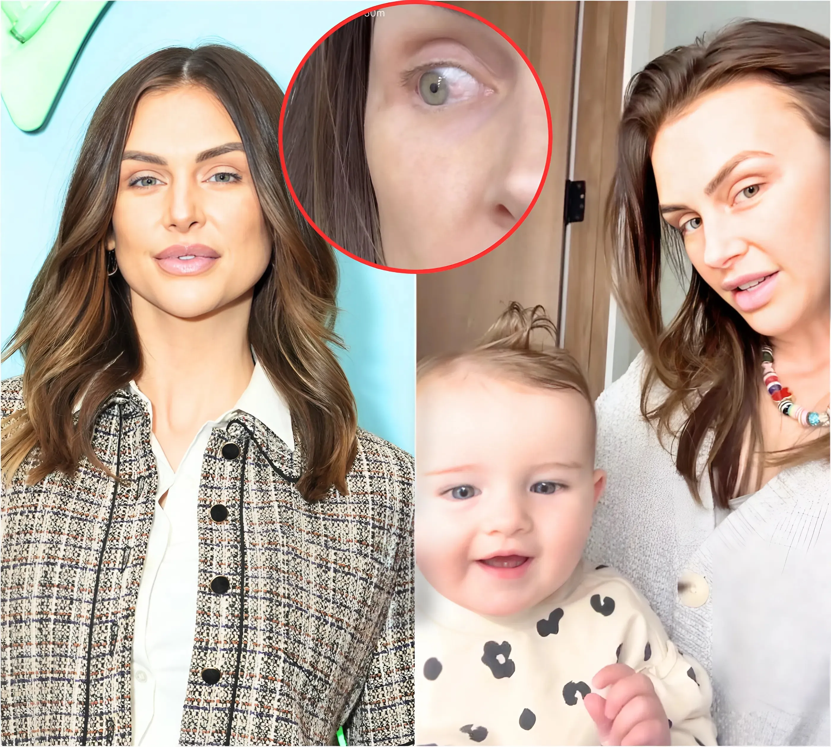Lala Kent Confirms Her Eye Abnormality Has Been Diagnosed as Pre-Cancer & Shares What's Next