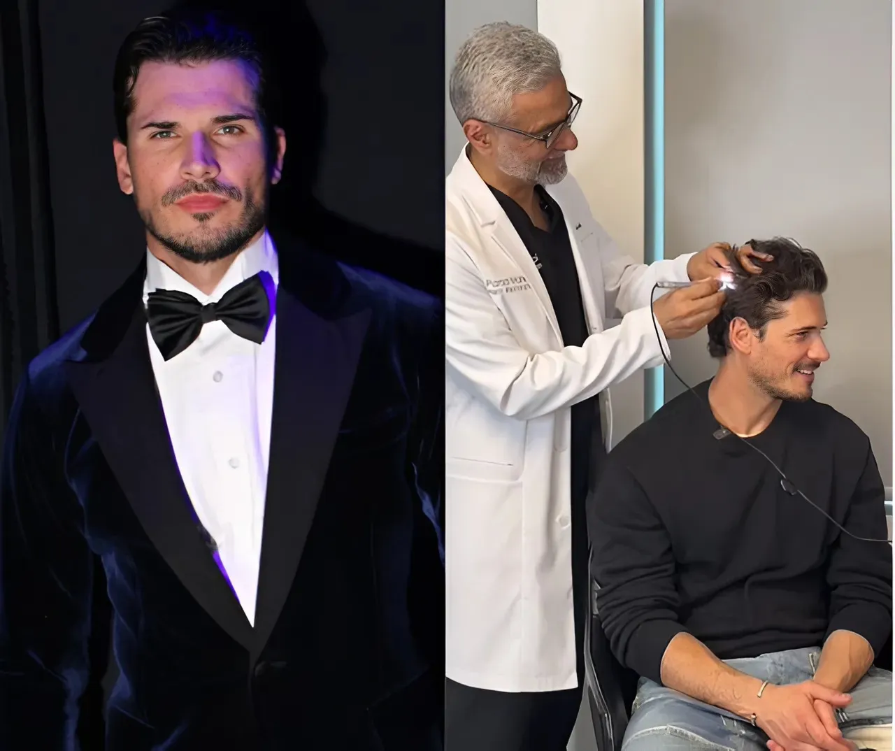 DWTS Pro Gleb Savchenko Shares Hair Loss Journey With Fans