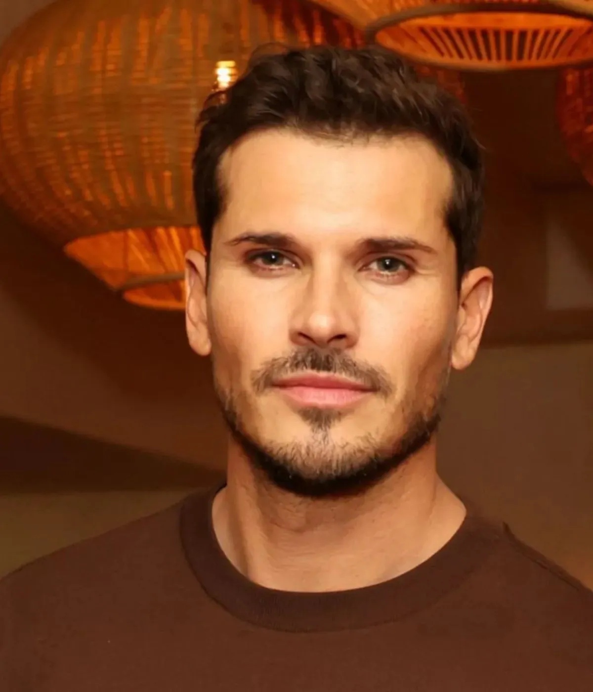 DWTS Pro Gleb Savchenko Shares Hair Loss Journey With Fans