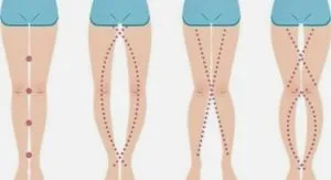 P4. THE LEGS OF A WOMAN CAN SAY AS IT IS THEIR V*GIN