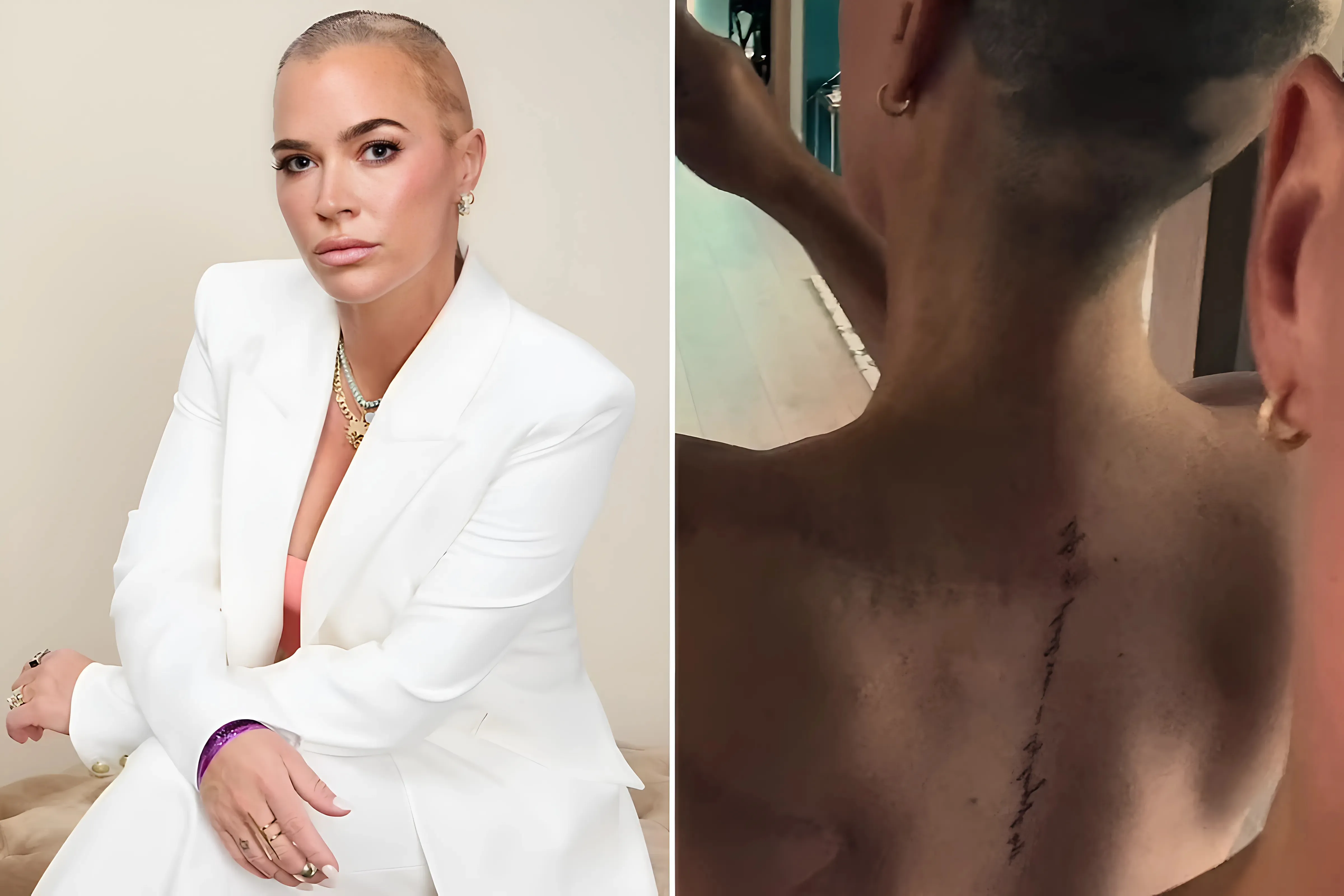 Teddi Mellencamp debuts eight-word tattoo over surgery scar with sentimental meaning amid grueling cancer battle