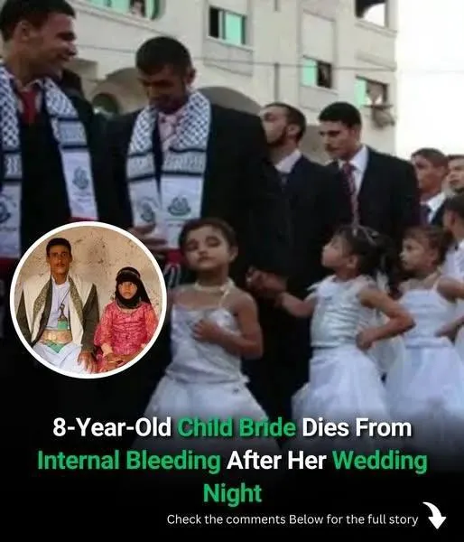 After her wedding night, an 8-year-old child bride passes away from internal bleeding.