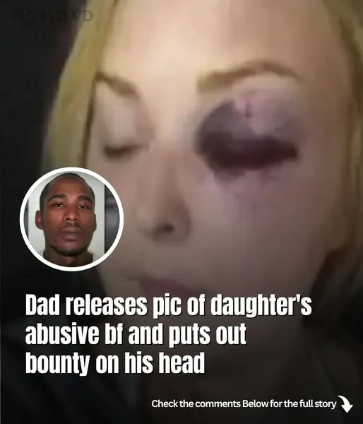 Dad Posts A Bounty On His Head And Shares A Picture Of His Daughter’s Abusive Boyfriend