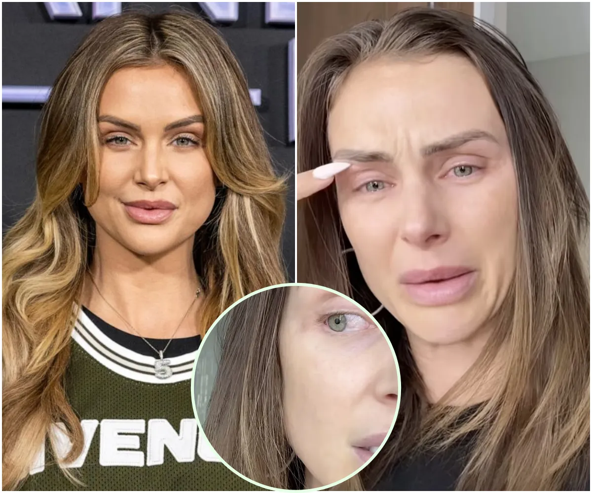 Lala Kent Struggles With Painful Chemotherapy for Her Eyes - Sharing Horrific Side Effects, Public Doubt, and Pressure from Impending Surgery - suong