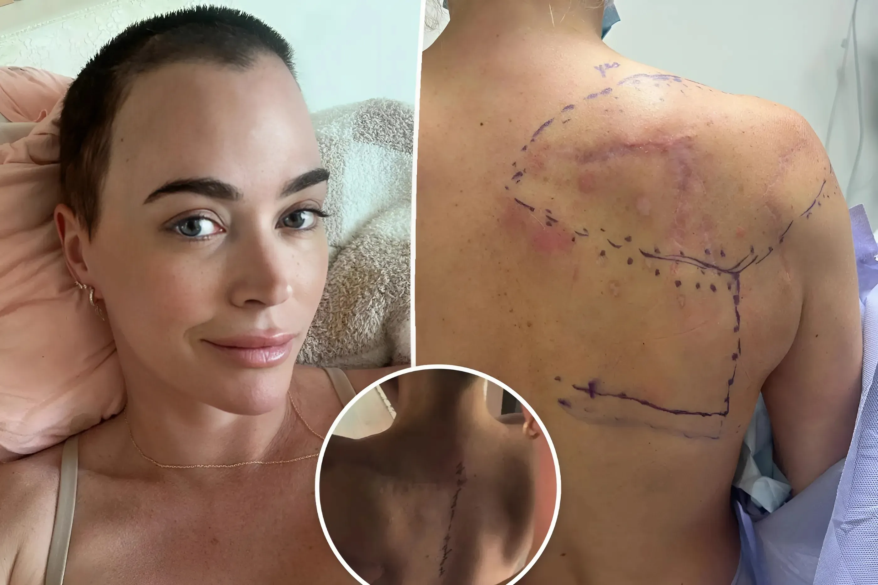 Teddi Mellencamp shows off meaningful new tattoo over surgery scar — with a connection to her famous dad