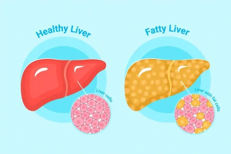 16. CLEANSES FATTY LIVER