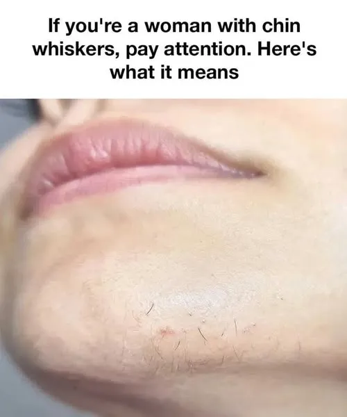 If you’re a woman with chin whiskers, pay attention. Here’s what it means