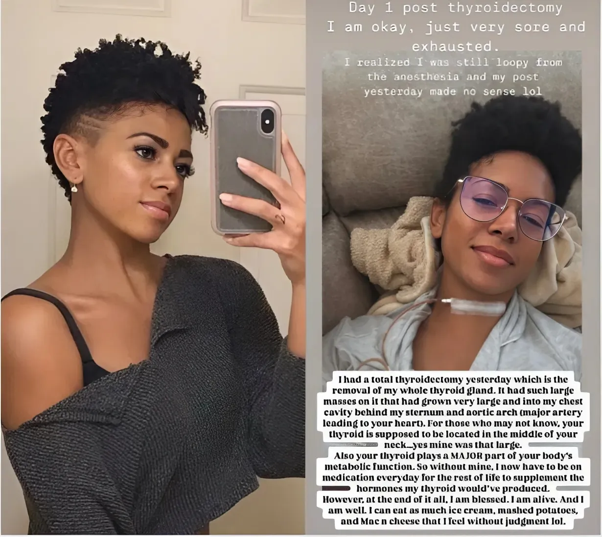 Shiann Lewis Recovers from Major Thyroidectomy Surgery: ‘I Am Alive’