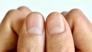 P4. What does the half moon at the base of the nails mean?