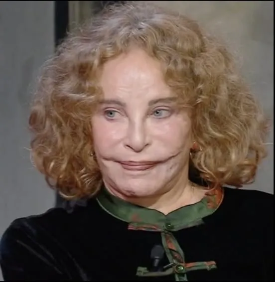 Film star Sydne Rome disappeared from Hollywood – a tragic accident left her scarred for life