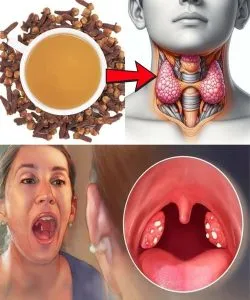 9. Got a Sore Throat? Try This Tiny Spice That Works Like Nature’s Antibiotic 9. Got a Sore Throat? Try This Tiny Spice That Works Like Nature’s Antibiotic