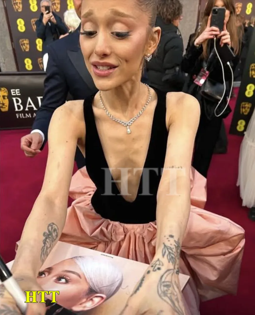 Ariana Grande’s Appearance at the BAFTAs Sparks Concern—Fans Sound the Alarm Over Her Health