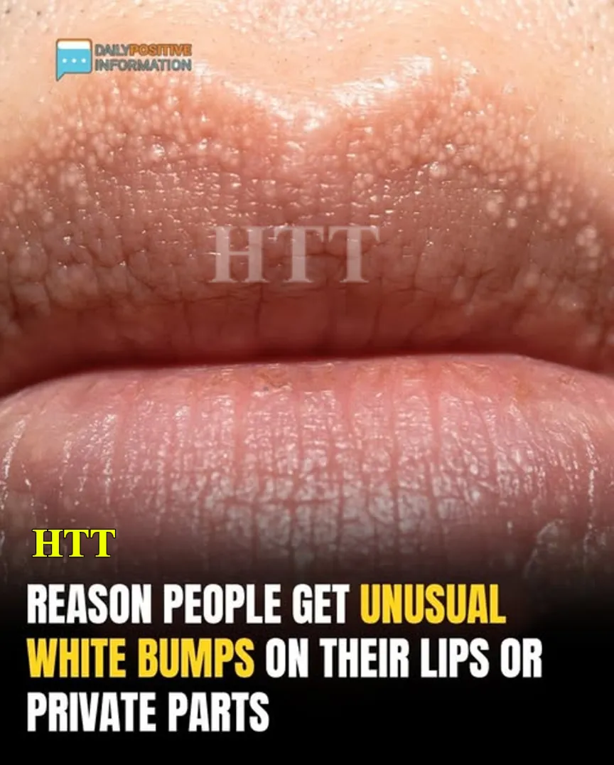 The Cause Of The Odd White Pimples On Your Your Body