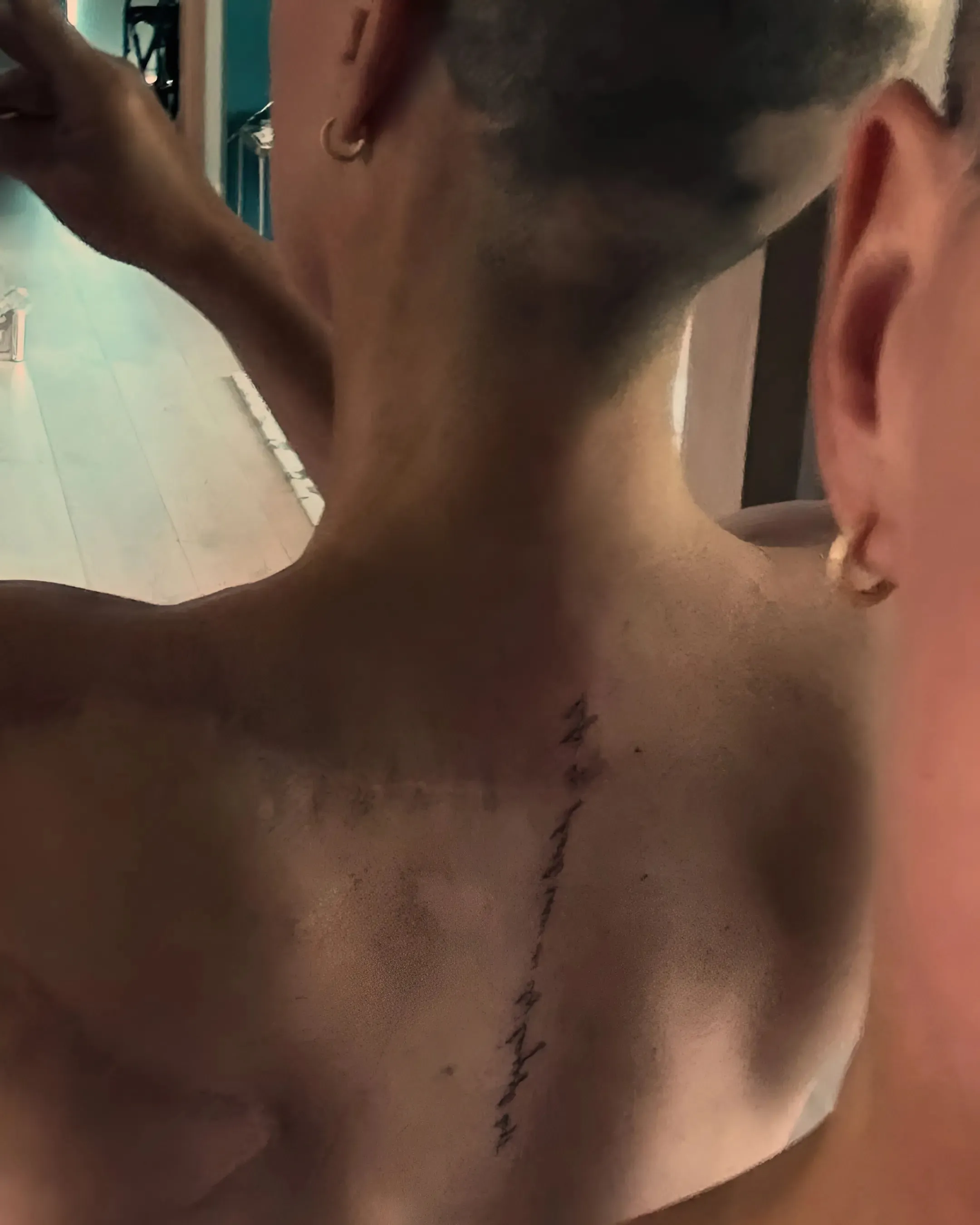 Teddi Mellencamp Gets Tattoo Over Cancer Surgery Scar