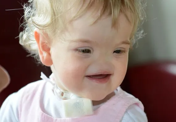 4. Tessa Evans' Rare Condition: Overcoming Challenges 4. Tessa Evans' Rare Condition: Overcoming Challenges