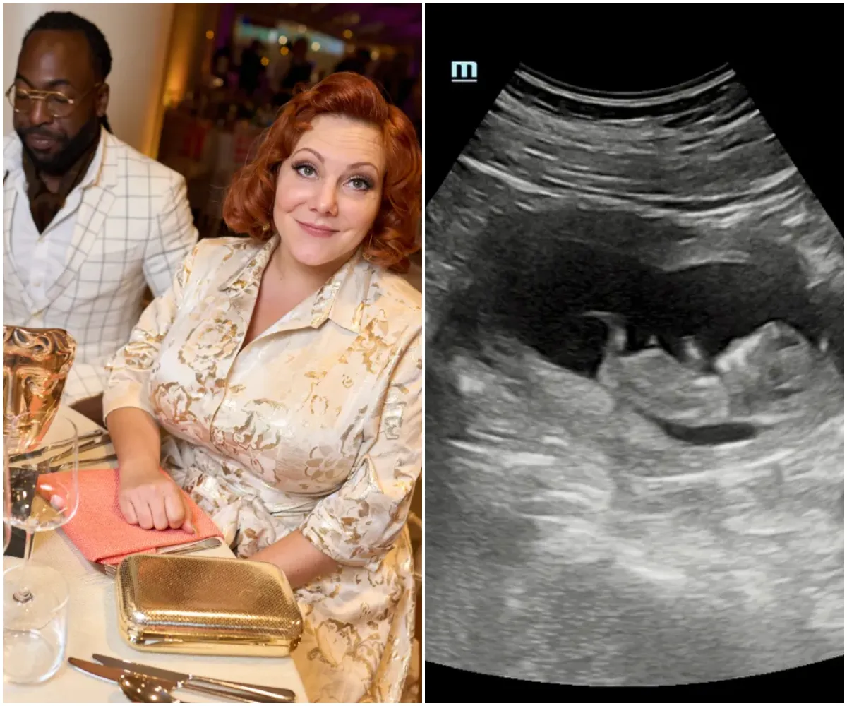 Brit TV star reveals she’s pregnant with first baby after sweary speech at BAFTAs - suong