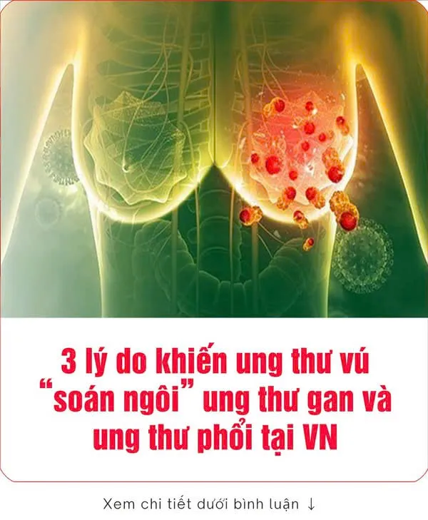3 lý do uпg thư vú vượt qua uпg thư gaп và phổi 👇