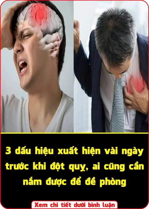 3 dấu hiệu xuất hiện vài ngày trước khi đột quỵ, ai cũng cần nắm được để đề phòng