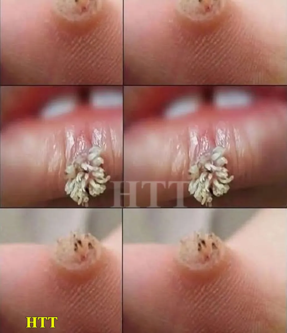 If you get this, you are infected with… See more