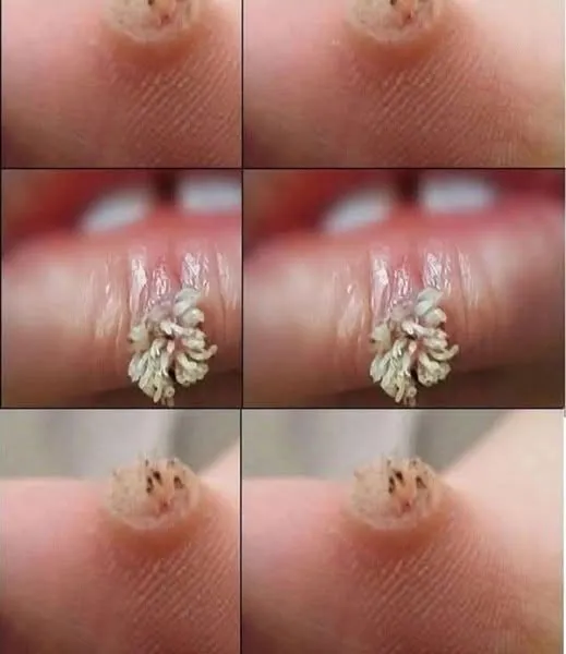 If you get this, you are infected with