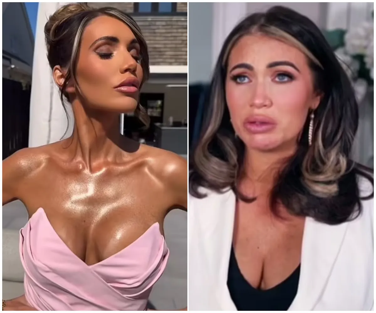‘I’ve never been in so much pain’: Amy Childs left bedridden by mystery illness after dramatic 2-stone weight loss – as fans express concern over her shockingly slim new look - suong