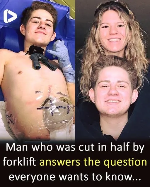 19-year-old crushed by forklift chooses to amputate bottom half of his body 19-year-old crushed by forklift chooses to amputate bottom half of his body