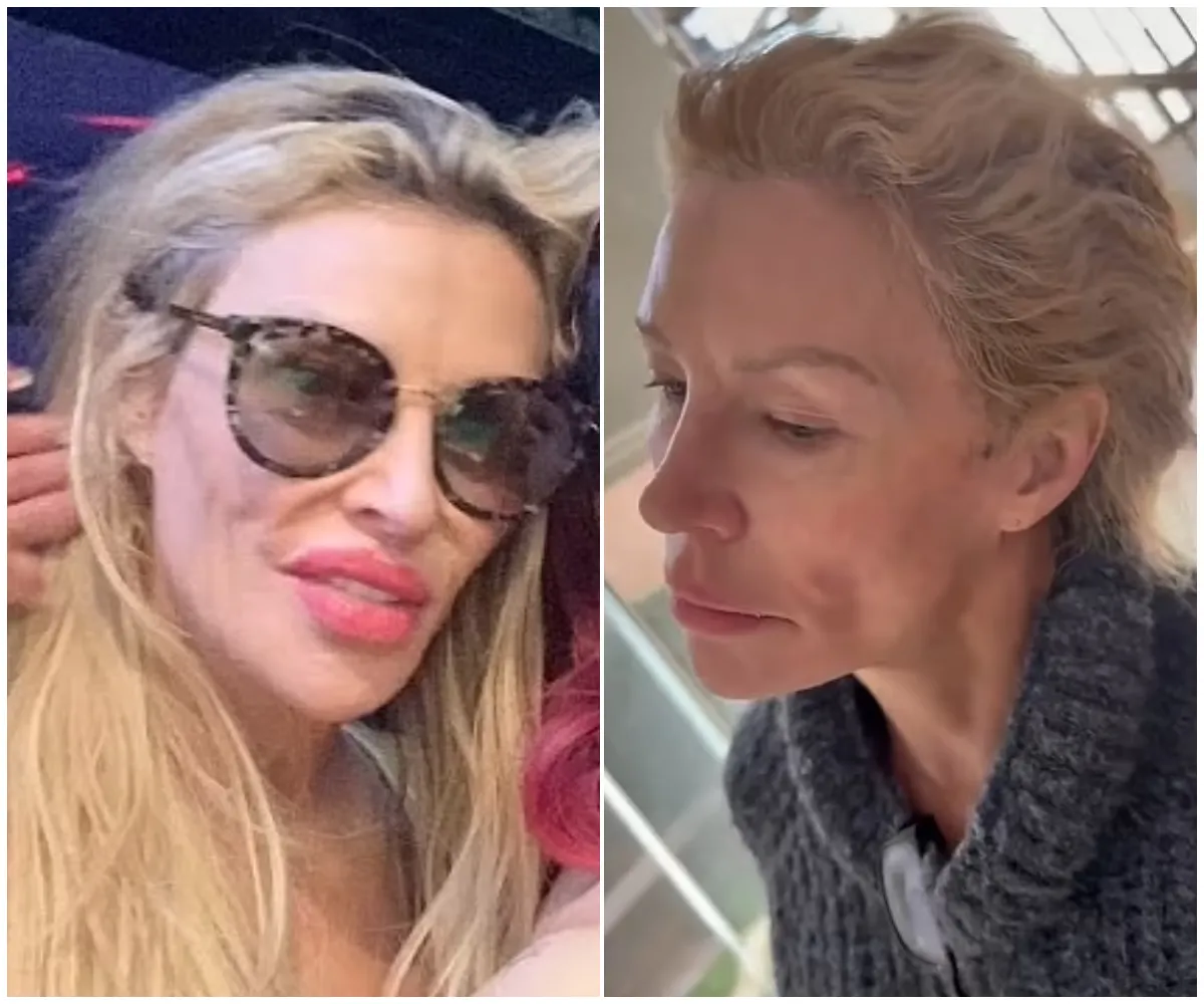 'I was hiding' RHOBH alum Brandi Glanville breaks silence after months in hiding – reveals $113,000 battle with mystery facial condition, slams 'cruel' trolls and vows to remove filters forever - suong