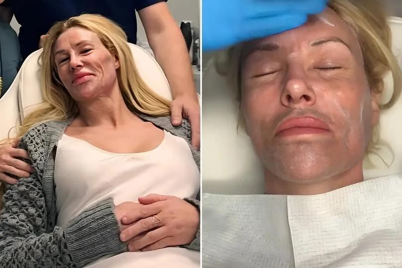 Brandi Glanville makes heartbreaking confession two years after life-changing mystery illness left her face disfigured