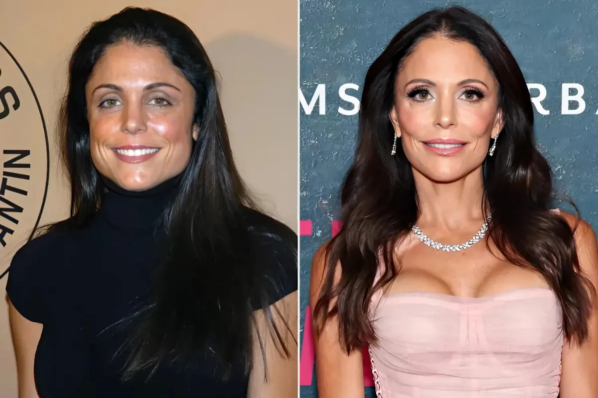 Bethenny Frankel Slams 'Haters' Who Are Upset She 'Looks Better' Than 20 Years Ago: 'I Hadn't Found Jaw Botox'-quang