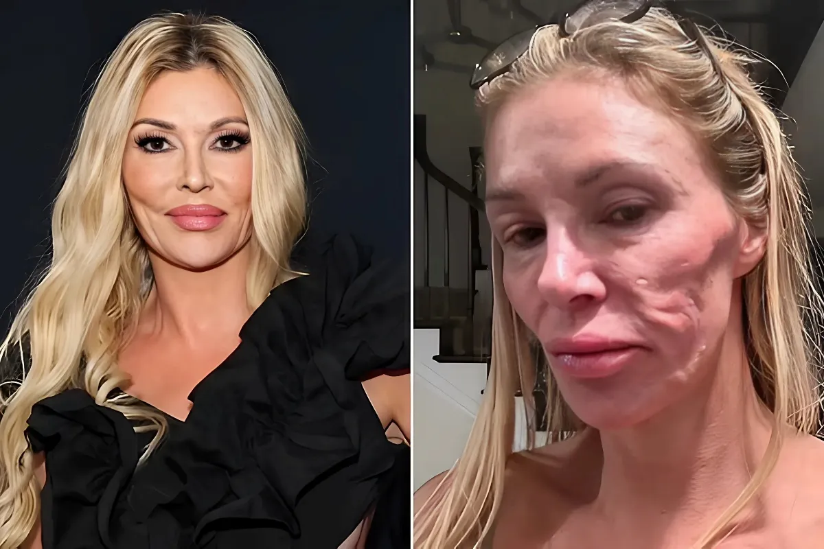 Brandi Glanville's Emotional Revelation: Reflecting on Life-Altering Illness and its Profound Impact After Two Years - lulu
