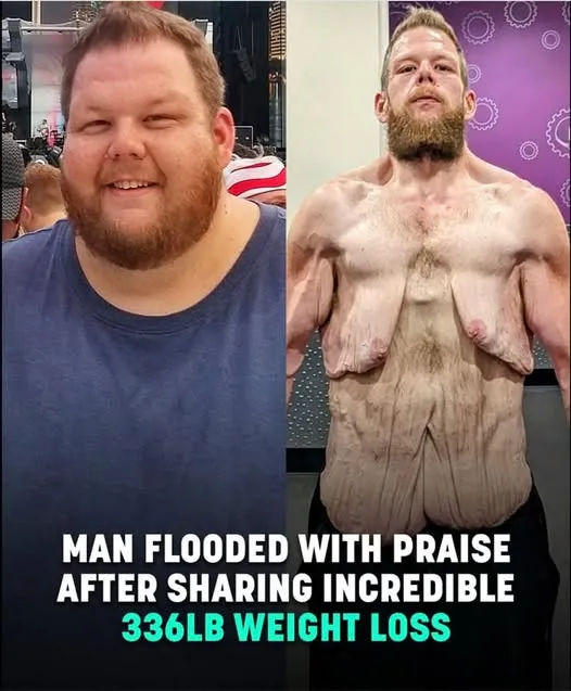 Internet praises man for 360lb weight loss Internet praises man for 360lb weight loss