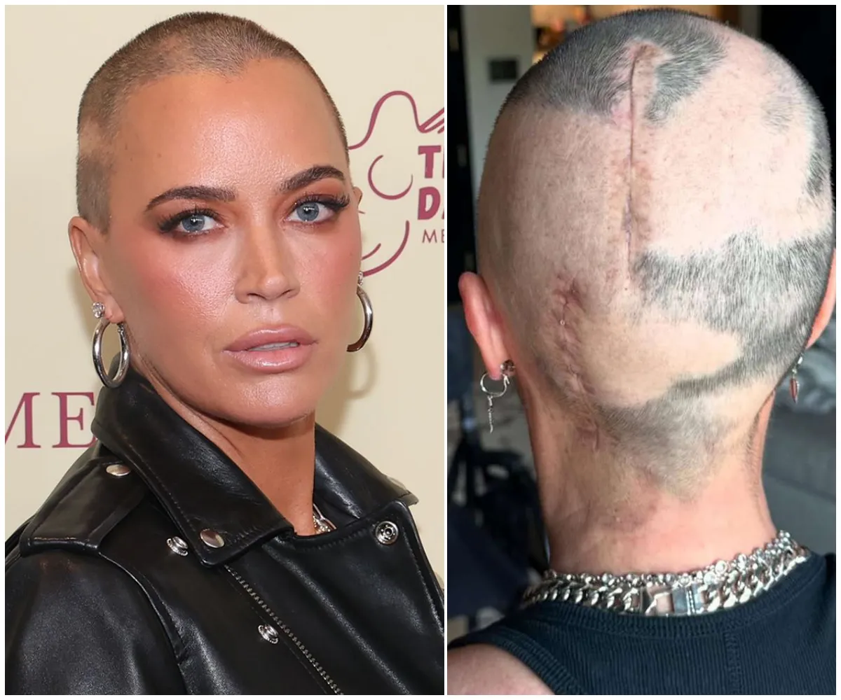 ‘I Was a Nothing Burger!’ Teddi Mellencamp Breaks Silence on Real Reason She Was Fired from RHOBH as She Recalls Wild Sex Story Involving Another Couple on the Same Bed - suong
