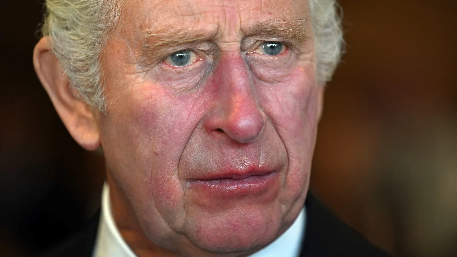 4. A great tragedy! What King Charles feared has happened, Prince Harry has “had an inci...