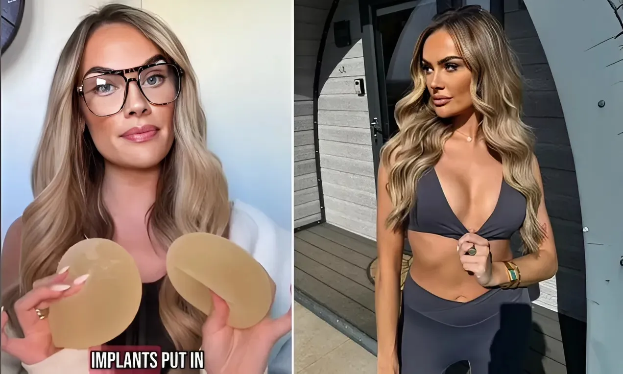 MAFS Bride Shares Stunning Before-and-After Photos of New Boob Job After Removing ‘Toxic’ Implants trucc