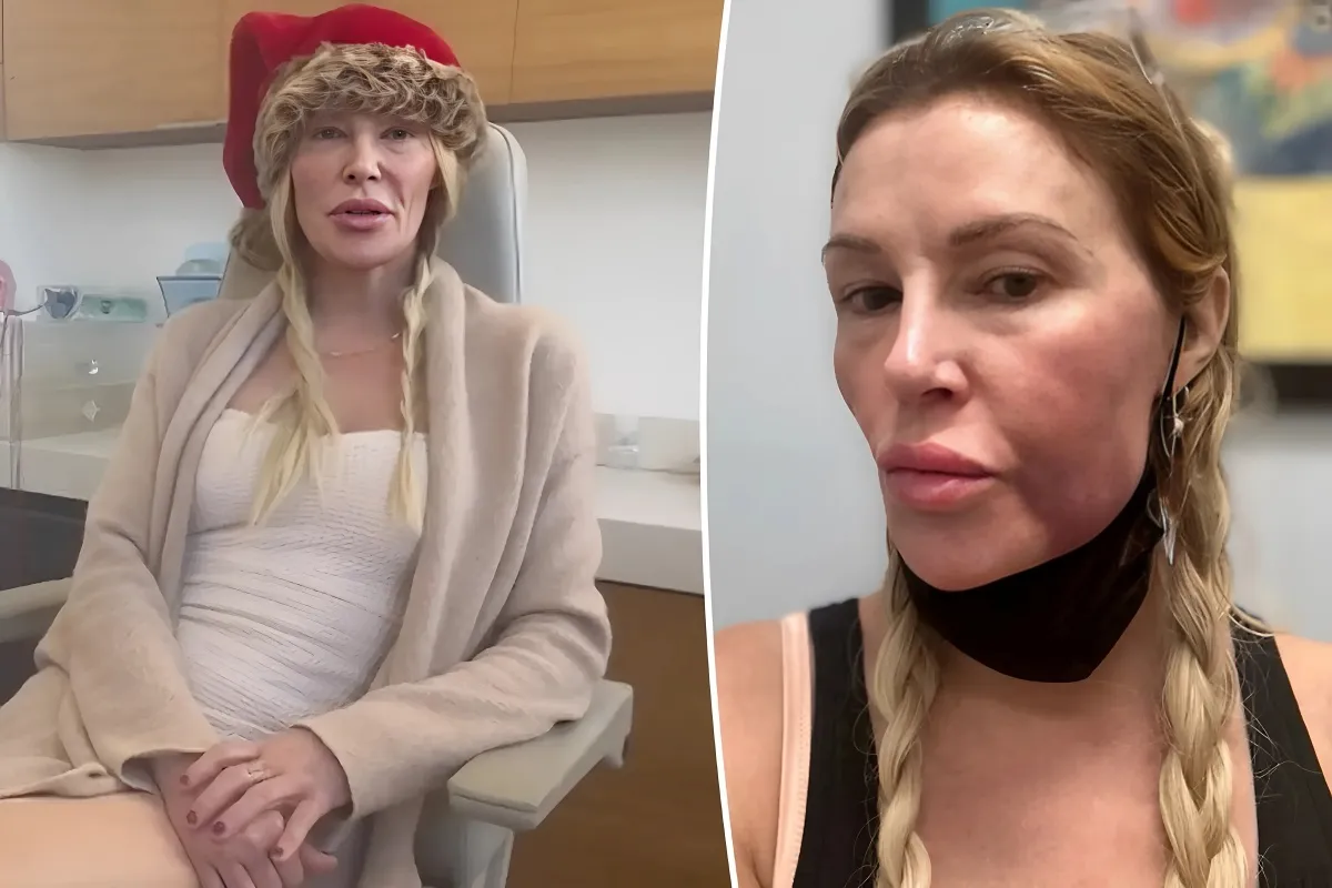 Brandi Glanville, 52, leaves little to the imagination as she poses for topless snaps after life-changing mystery illness left her face disfigured - lulu