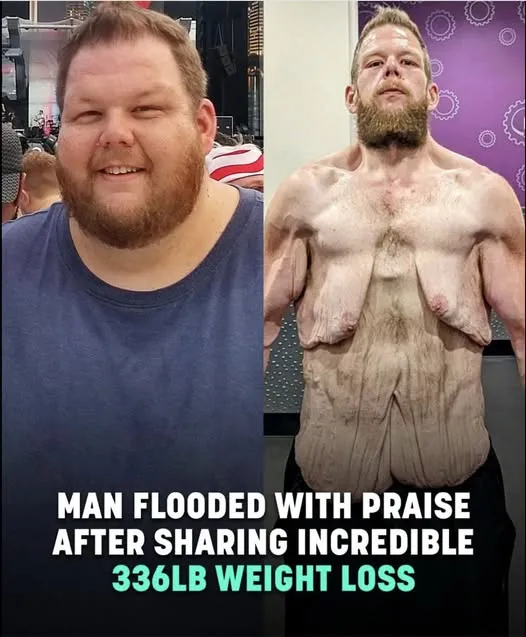 Internet praises man for 360lb weight loss