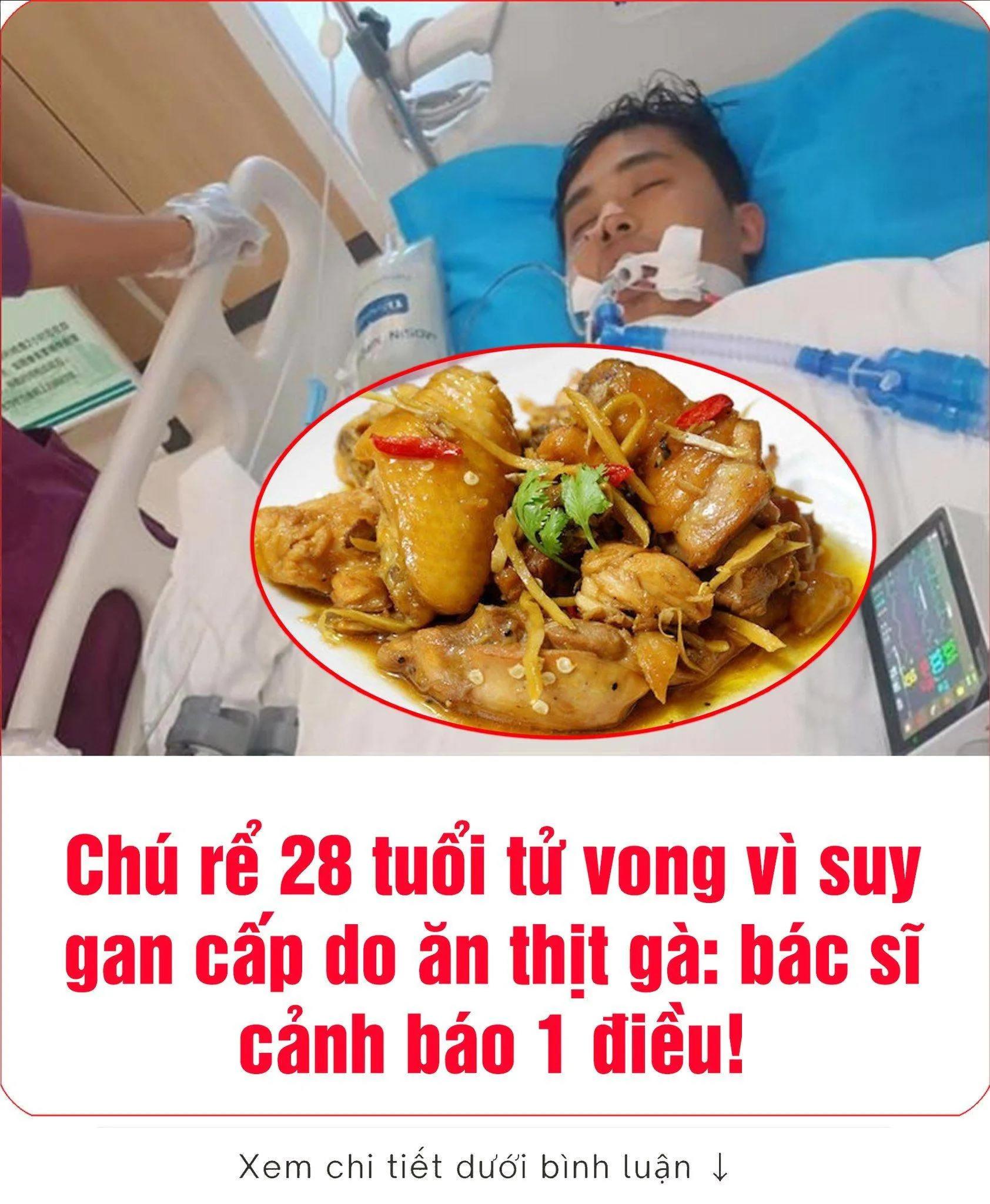 Chú rể 28 tuổi tử vong vì suy gan cấp do ăn thịt gà, bác sĩ cảnh báo 1 điều!