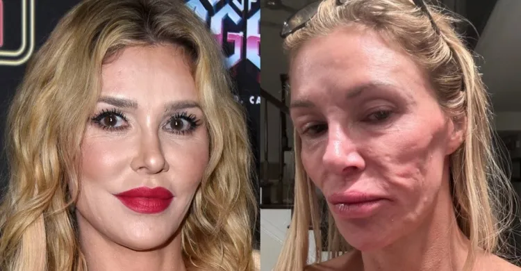 Brandi Glanville reveals shocking impact of her disfigured face on her sex life