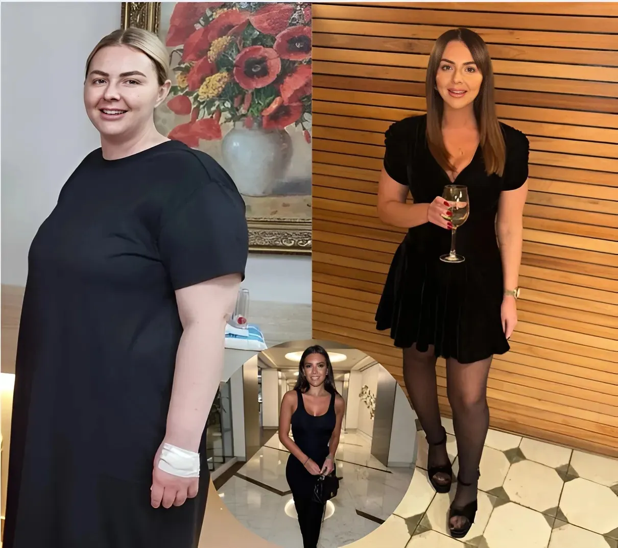 I was size 22 eating FIVE takeaways a week – now I’m told I look like Gemma Owen after 8st weight loss without jabs