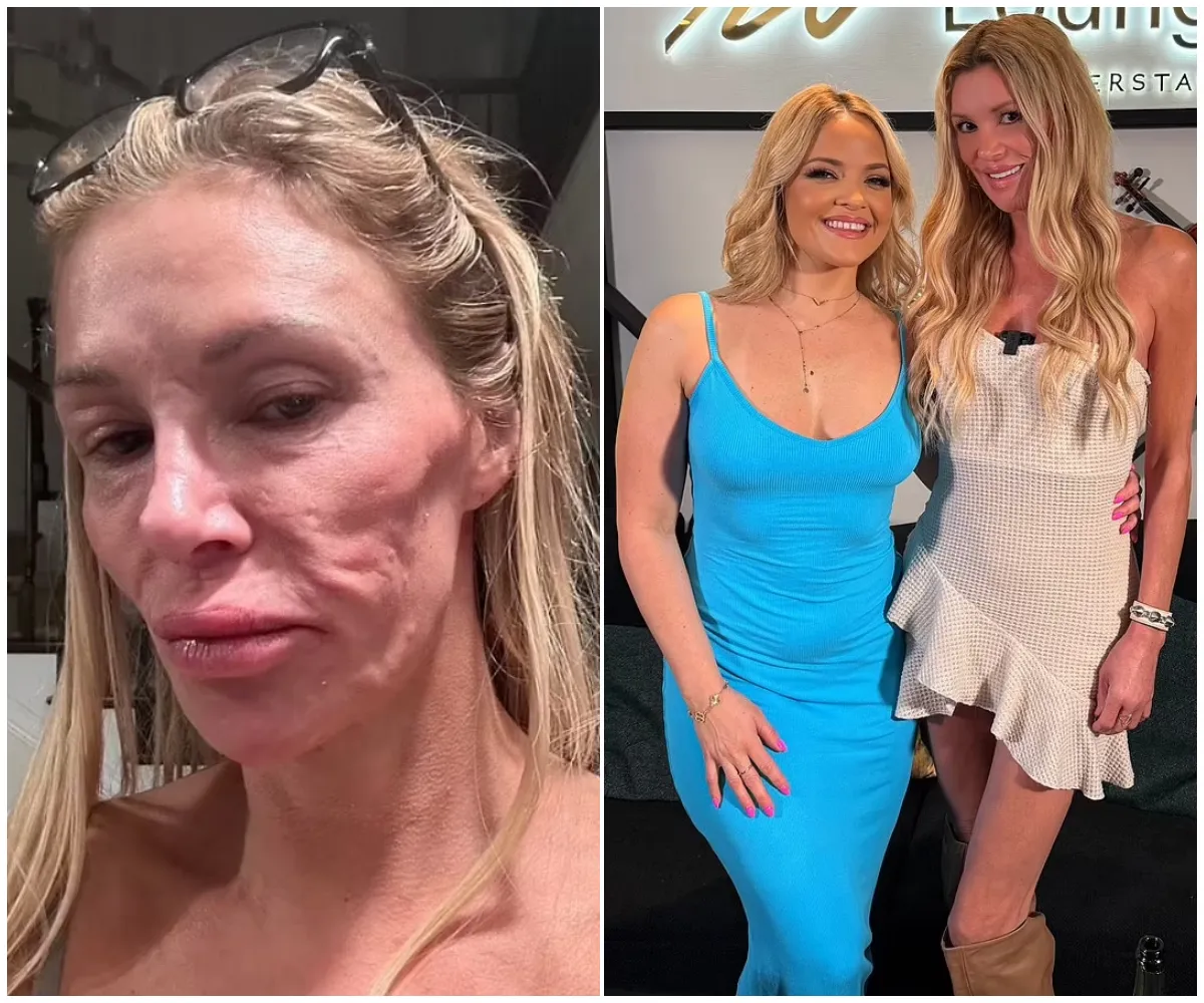 Brandi Glanville reveals shocking impact of her disfigured face on her sex life - suong